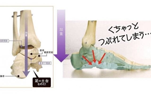 その疲れやトラブル 足のアーチが原因かも？
