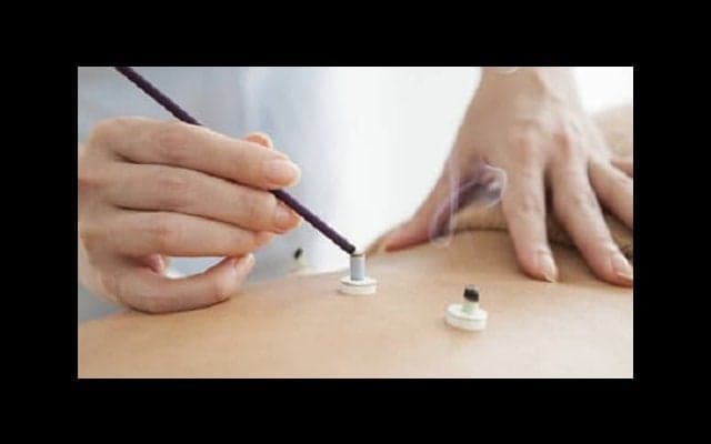 骨折後の後遺症に鍼灸治療が効果的