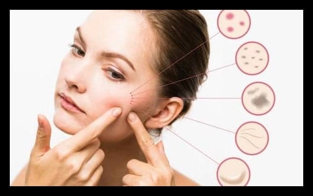 秋の肌ケア法をご紹介！