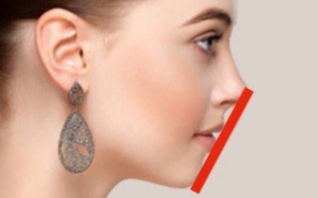 憧れのEラインは作れる！今すぐ始められる最も簡単で最強の対策とは