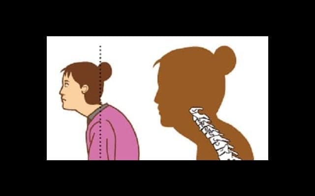 ストレートネックの原因とは