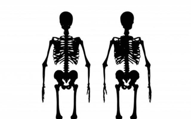 骨格の歪みの原因とは？