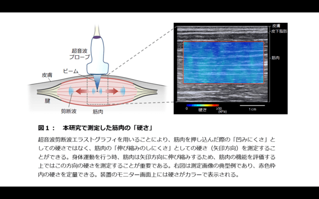 アスリートの筋肉の硬さが競技パフォーマンスに影響…順天堂
