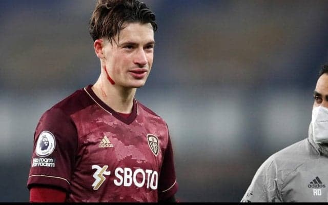 リーズに大きな痛手、ドイツ代表DFコッホがヒザの手術で離脱