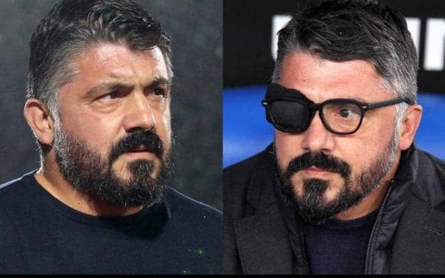 なぜ眼帯を？ ガットゥーゾ監督は現役時代から悩まされていた問題に対応