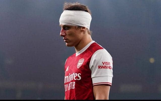 プレミアリーグ、2月6日から脳震とうによる交代2枠を追加へ