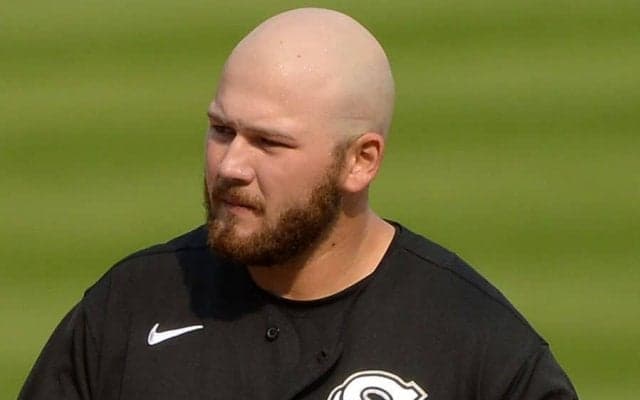 「申し訳ないけど笑う」　スキンヘッドのMLB選手を襲った悲劇、まさかの日焼け跡が話題
