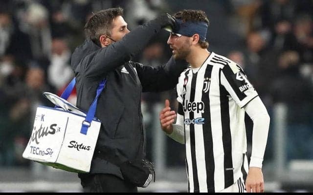 インテル戦で頭部負傷のロカテッリ、頭ではなく右ヒザのケガにより約20日間の離脱へ