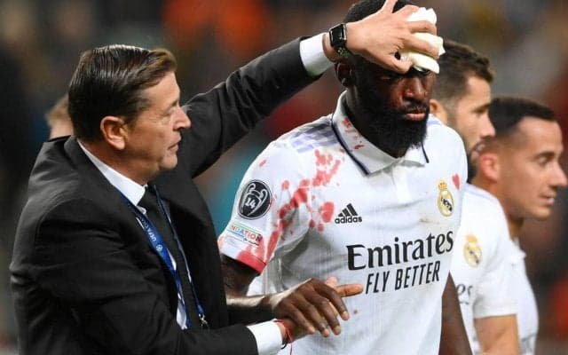 強い絆！ 頭部流血リュディガー、レアルが普段見せない治療までの一部始終を公開、アラバ＆クロースは最後まで見守る