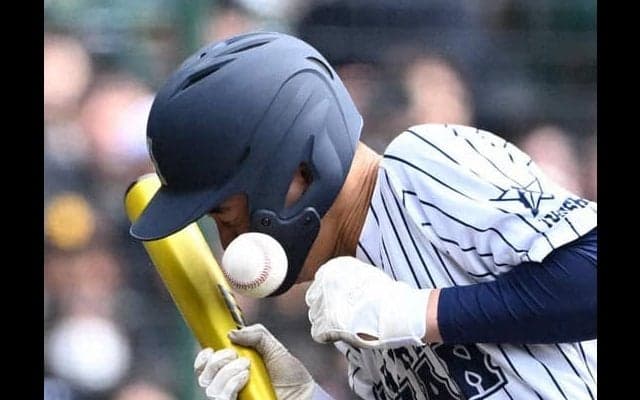 顔面付近に死球受けた阿南光・井坂選手は打撲傷と診断　センバツ
