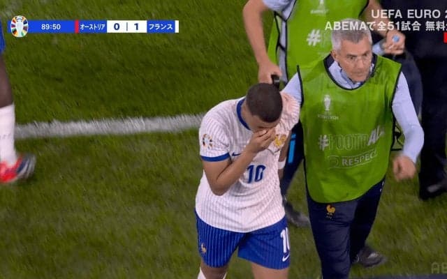 “鼻骨折”のエンバペ、手術は回避へ！「マスクのアイデアはある？」SNSでファンに呼びかけて大バズり【EURO】