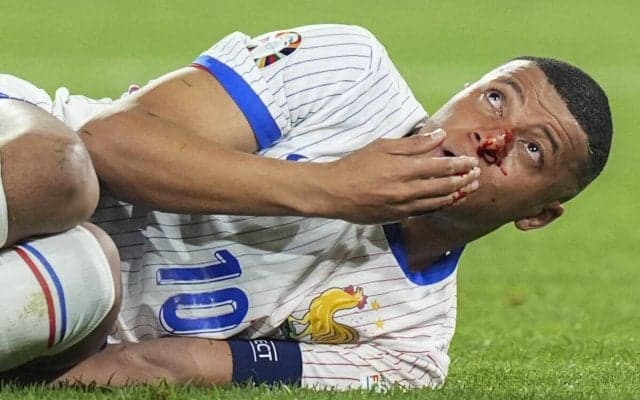 鼻骨骨折のムバッペ、オランダ戦欠場