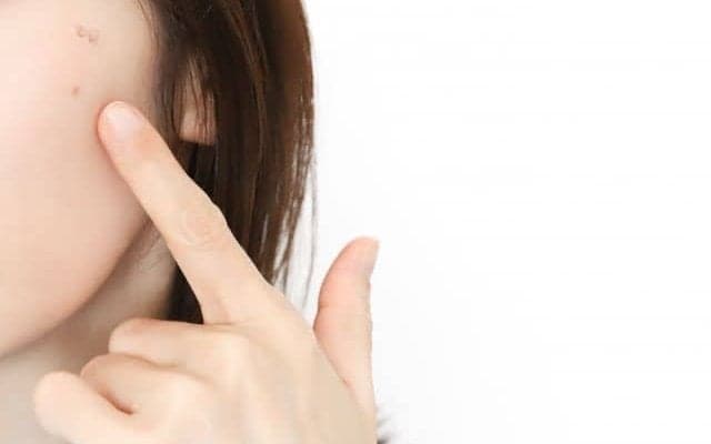 ピコレーザーってなに？解消できる様々な悩みをご紹介します