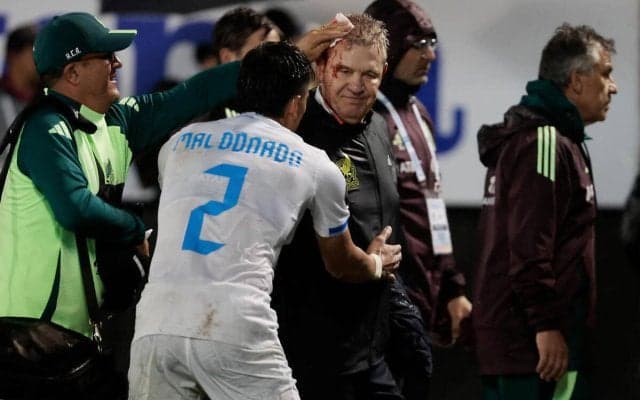 かつて日本を指揮したアギーレ監督が流血…相手ファンの投げた缶が直撃する事件、相手監督は批判「選手たちの努力を台無しにする」