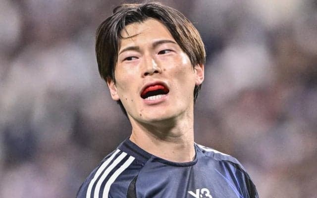 ｢電気グループ南部さんやん｣日本代表FW古橋亨梧の新天地アウェイユニ姿にファン困惑！｢なぜグラサン｣｢すげーヴィッセルの色違いユニ感｣などの声