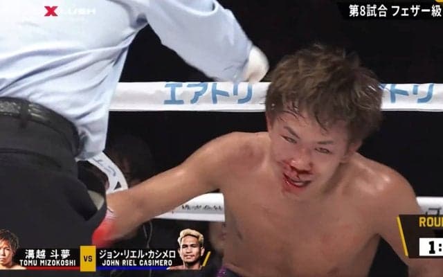 「止めろ危ない」「壊されてしまう」カシメロ、流血の衝撃TKO劇にファン戦慄 強打炸裂で「大丈夫か？」相手を気遣う余裕も