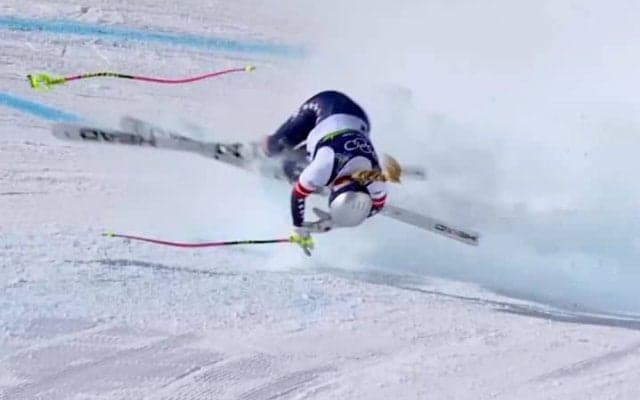 強行出場の代償　女子滑降ボン、壮絶な手術も左足切断の危機　専門医が問題視「足を残して歩けるように」【冬季五輪】