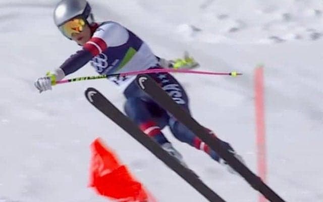 20本の金属ボルトが足中に…左足切断の危機を抱えた女子滑降ボンが告白した現況「痛みがなかなか治まりません」【冬季五輪】