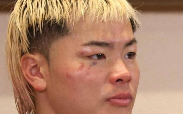 涙の復活星、那須川天心が雪辱祈願「拓真選手が勝つこと願って“てるてる坊主”作る」５・２井上拓真ＶＳ井岡一翔へ心境【一問一答】