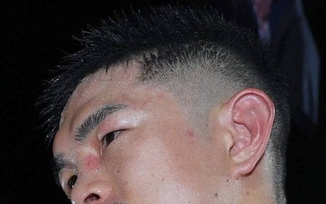 【ボクシング】井岡一翔も眼窩底骨折　妻・恵美さんがＳＮＳで明かす「あなたは永遠に世界一強くてかっこいいパパです」