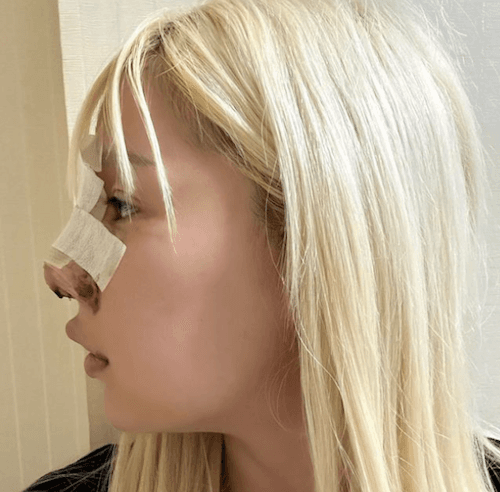 😵総額👛〇〇万⁉️夜ふかし📺多田さん、整形🏥レポ💦反響続く