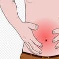 便秘や下痢、軟便を繰り返してしまう「過敏性腸症候群」をご存じですか？