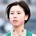 【北海道マラソン】「貼りすぎ」不破聖衣来、吉田響の丸形テープが再び話題に　どんな効果？