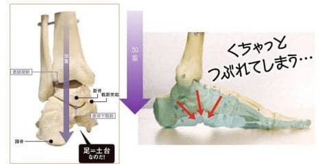 その疲れやトラブル 足のアーチが原因かも？