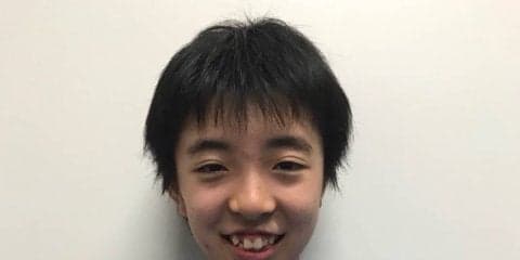 【卓球】東アジアホープス2017金メダルの13歳・小塩遥菜がVICTASと契約