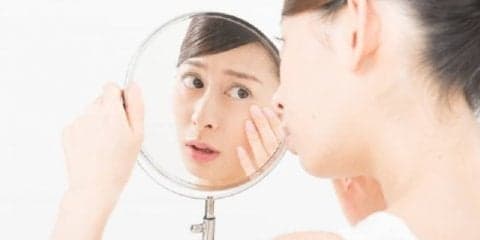 そのニキビ、原因はストレスかも！？大人ニキビの原因と対策