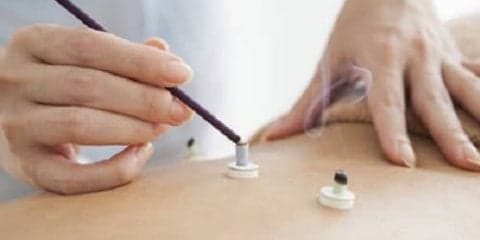 骨折後の後遺症に鍼灸治療が効果的