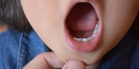 子どもの歯並びと身体の関係