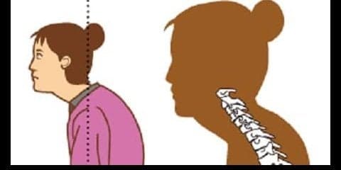 ストレートネックの原因とは