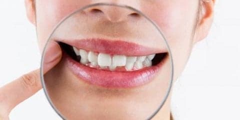 歯ぐきの黒ずみを治したい！原因と治療法を知ろう