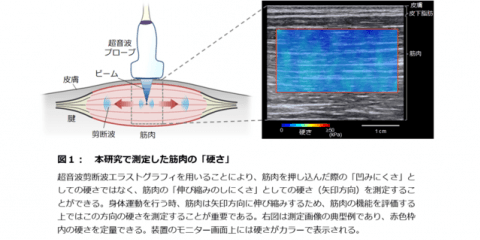 アスリートの筋肉の硬さが競技パフォーマンスに影響…順天堂