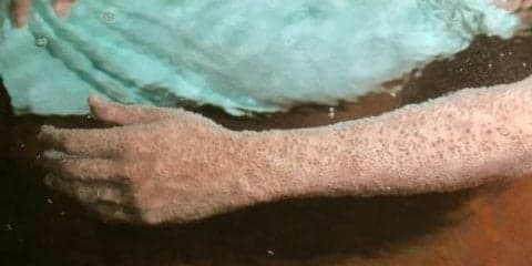 炭酸泉はメリットだらけ？！