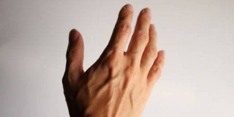 自分にもモヤモヤ血管があるの？という方へ