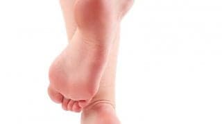 角質ケア要注意！危険なセルフフットケア