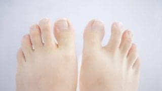 要注意！巻き爪になる７つの原因とは