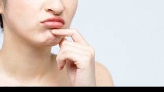 あごの梅干しじわを解消したい！原因と治療法とは