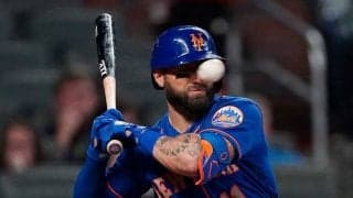 【MLB】151キロ顔面死球で鼻は曲がり、両目に青あざ…　痛々しい姿にファンも震撼