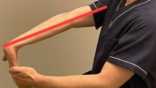 野球によるケガを防ぐには？