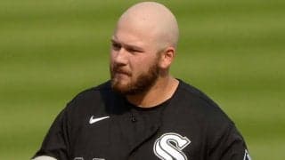 頭皮が日焼けで「オレンジスライスみたい」　キャンプでの悪夢に「苦情言いたい」