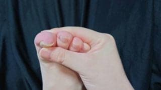 ツライ「こむら返り」は、歪みからくる冷えも原因だった！？