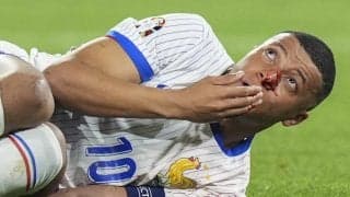 鼻骨骨折のムバッペ、オランダ戦欠場