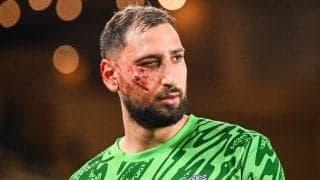 スパイク裏を顔面に受けたドンナルンマがひどい裂傷、数日間の離脱と追加検査に