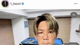 「顔、半分誰かわからんねんけどどないする？」人気格闘家・皇治が衝撃投稿　顔面腫れ、別人のような姿に・・・ネット驚き「別人すぎて」「誰？」「最初誰か分からんかった」