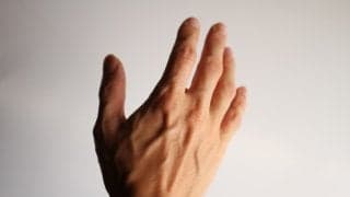 自分にもモヤモヤ血管があるの？という方へ