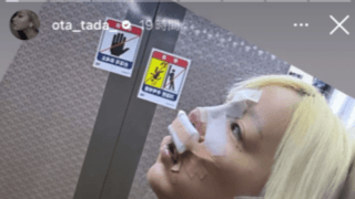 「抜糸して日本🇯🇵帰ります」夜ふかし📺多田さん、韓国🇰🇷リアル😵整形🏥レポ💦大反響